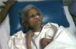 Mumbai Nurse Aruna Shanbaug, In Coma for 42 Years After Rape, in Critical Condition